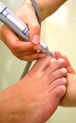 Darstellung der medizinischen Fußpflege
